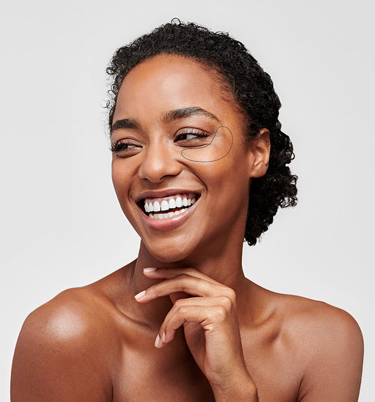 3 conseils pour prévenir l'hyperpigmentation et empêcher les taches brunes d'apparaitre