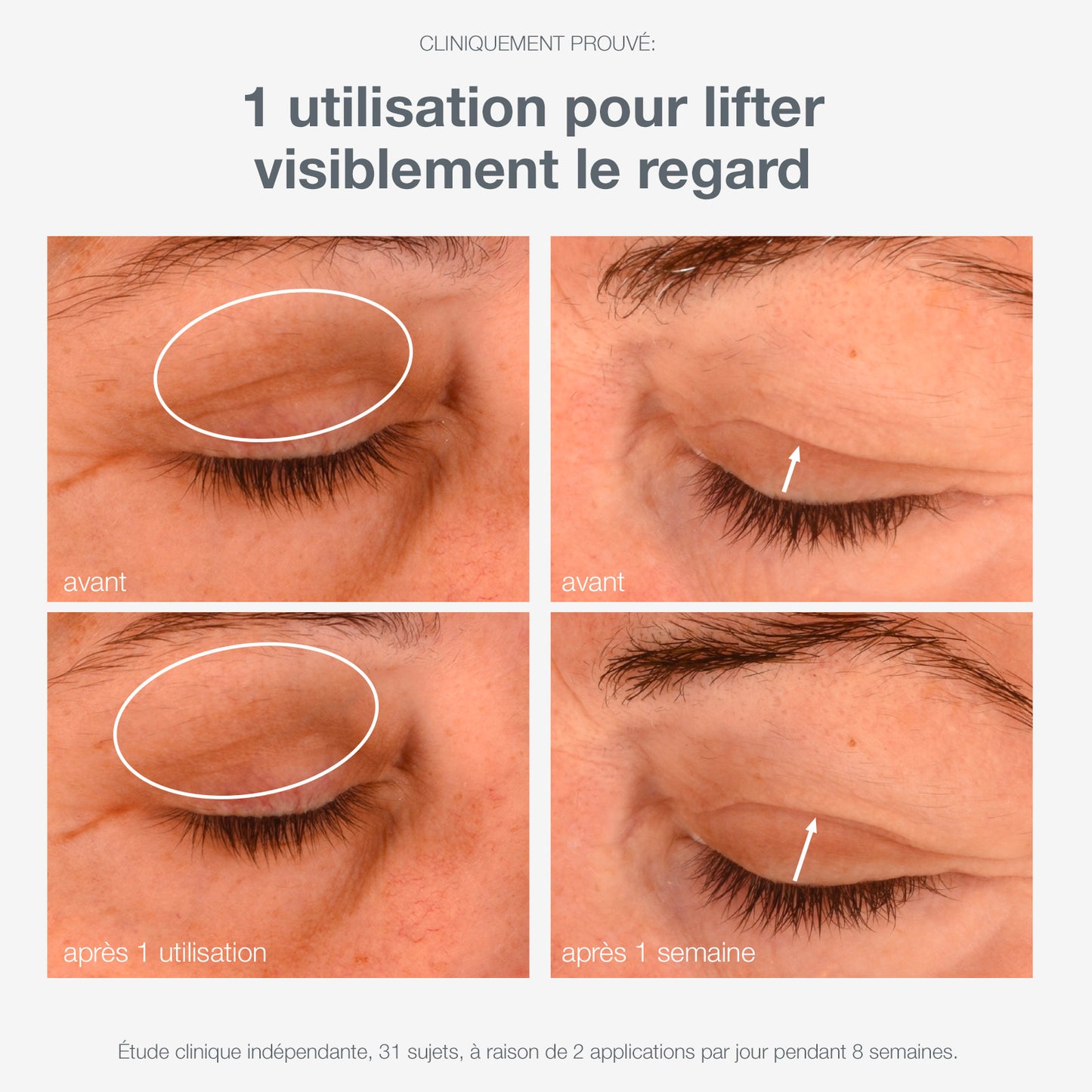 phyto nature lifting eye cream | crème contour des yeux liftante et raffermissante