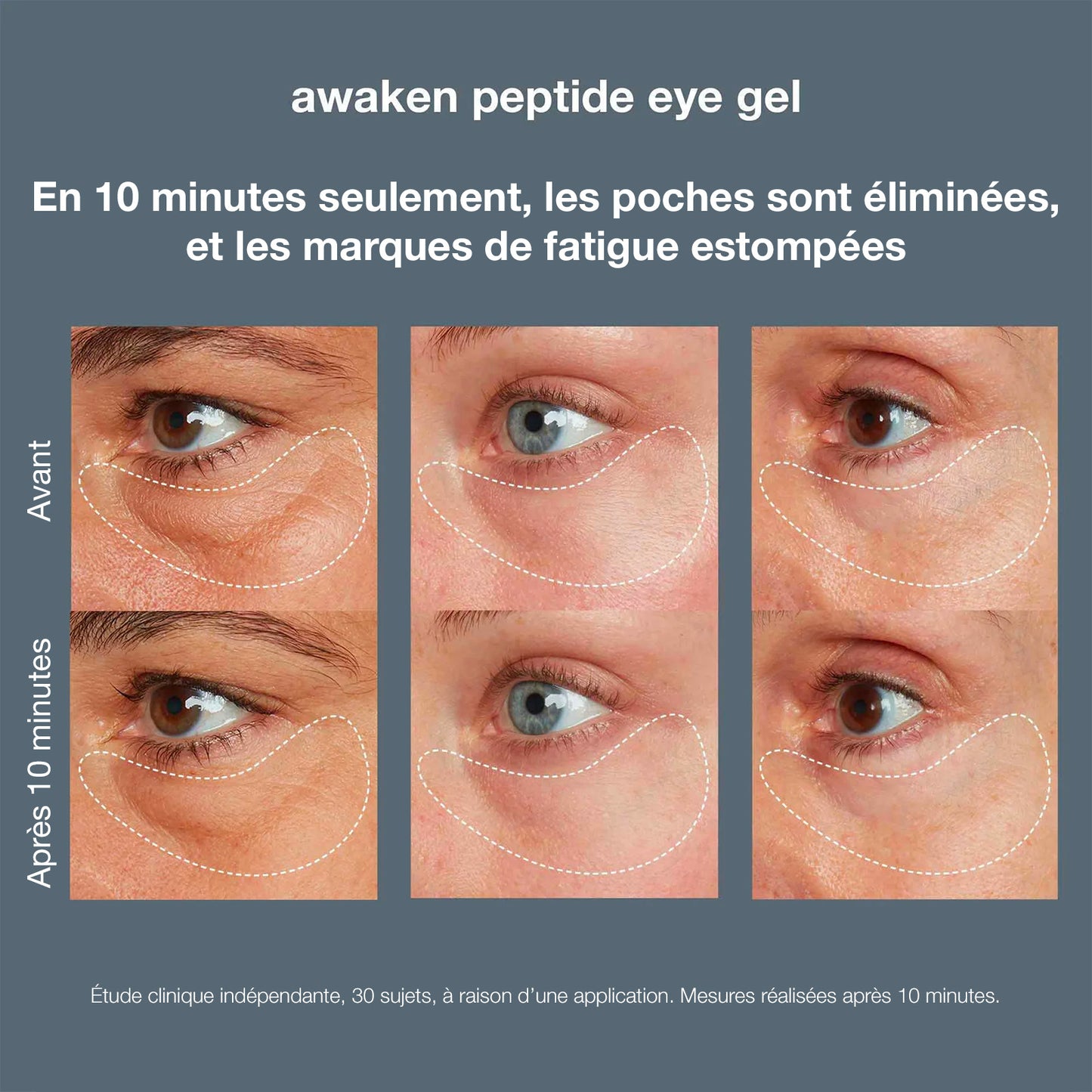 Awaken peptide eye gel | Contour des yeux anti poches aux peptides