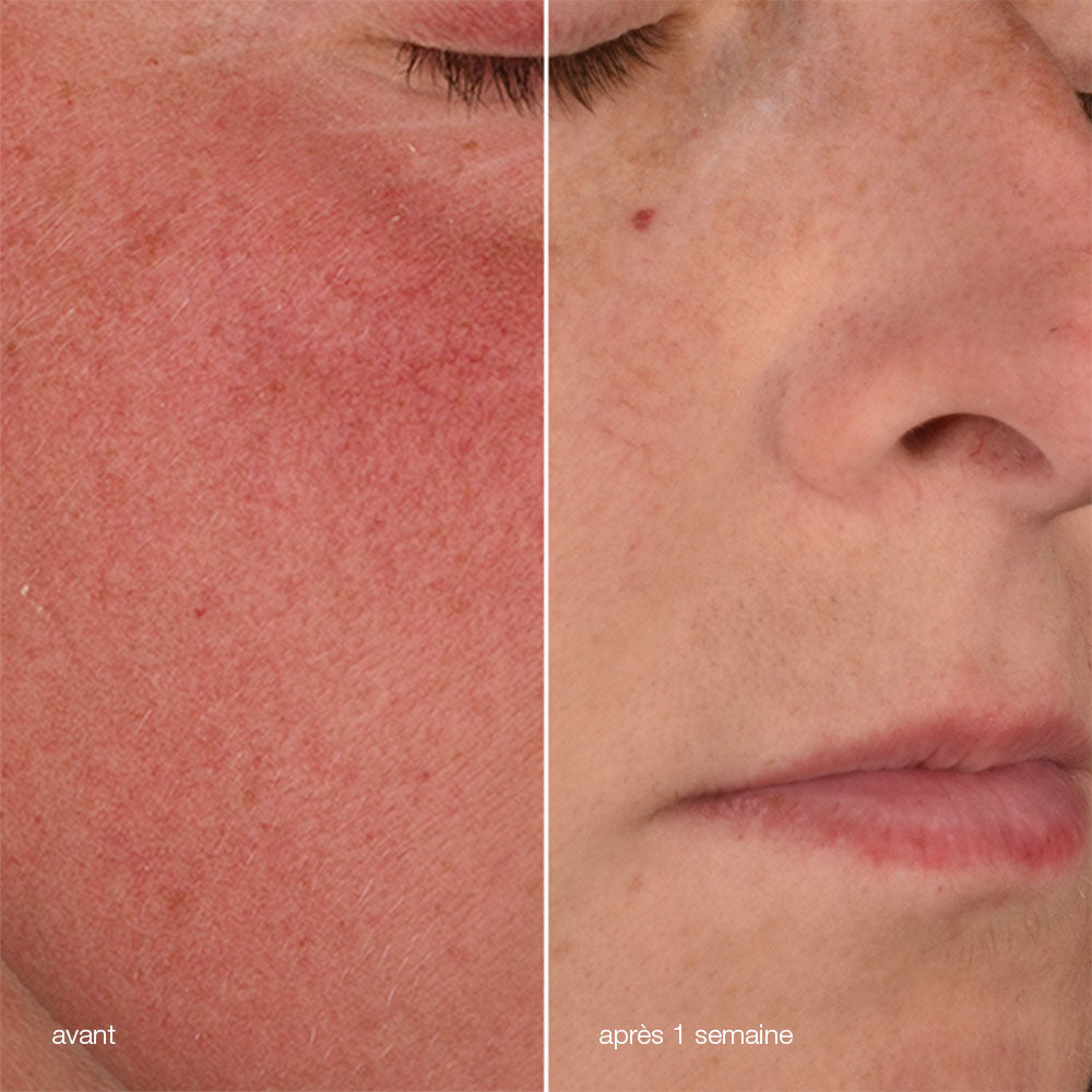 bundle - stabilizing repair cream