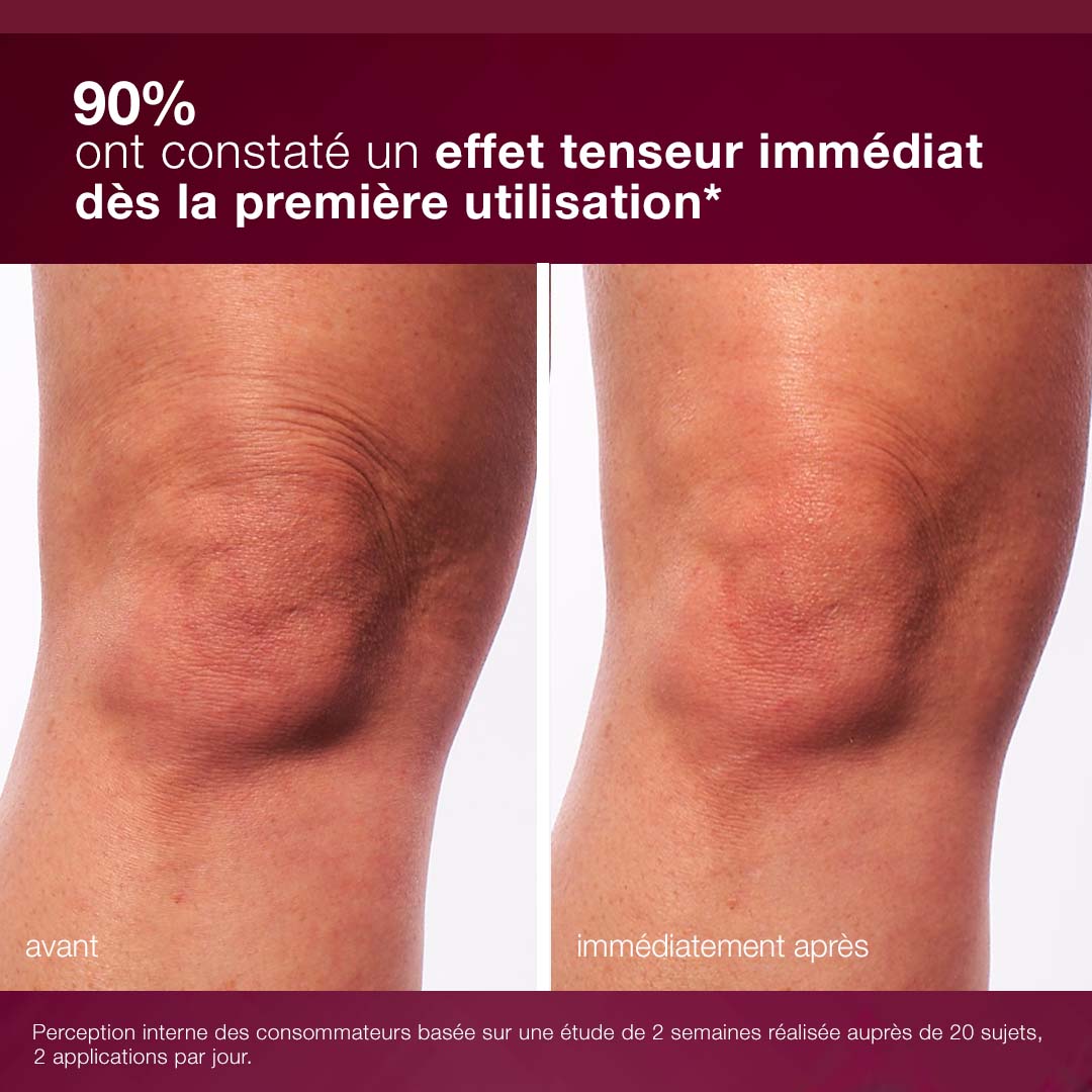 dynamic skin sculptor | sérum sculptant corps haute technologie – complexe pro-NAD+