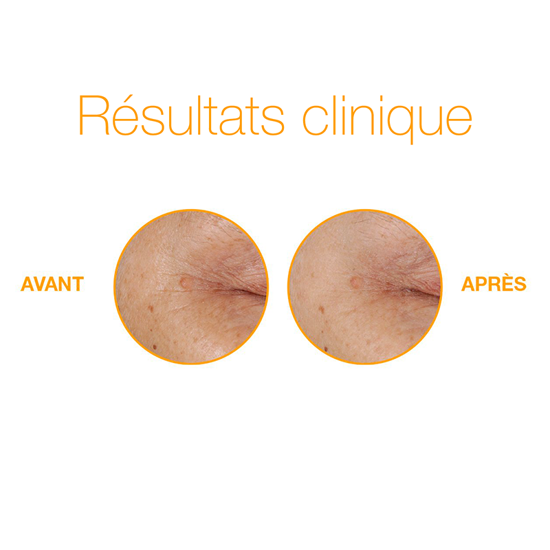 duo éclat vitamine C | biolumin-c serum et biolumin-c eye serum