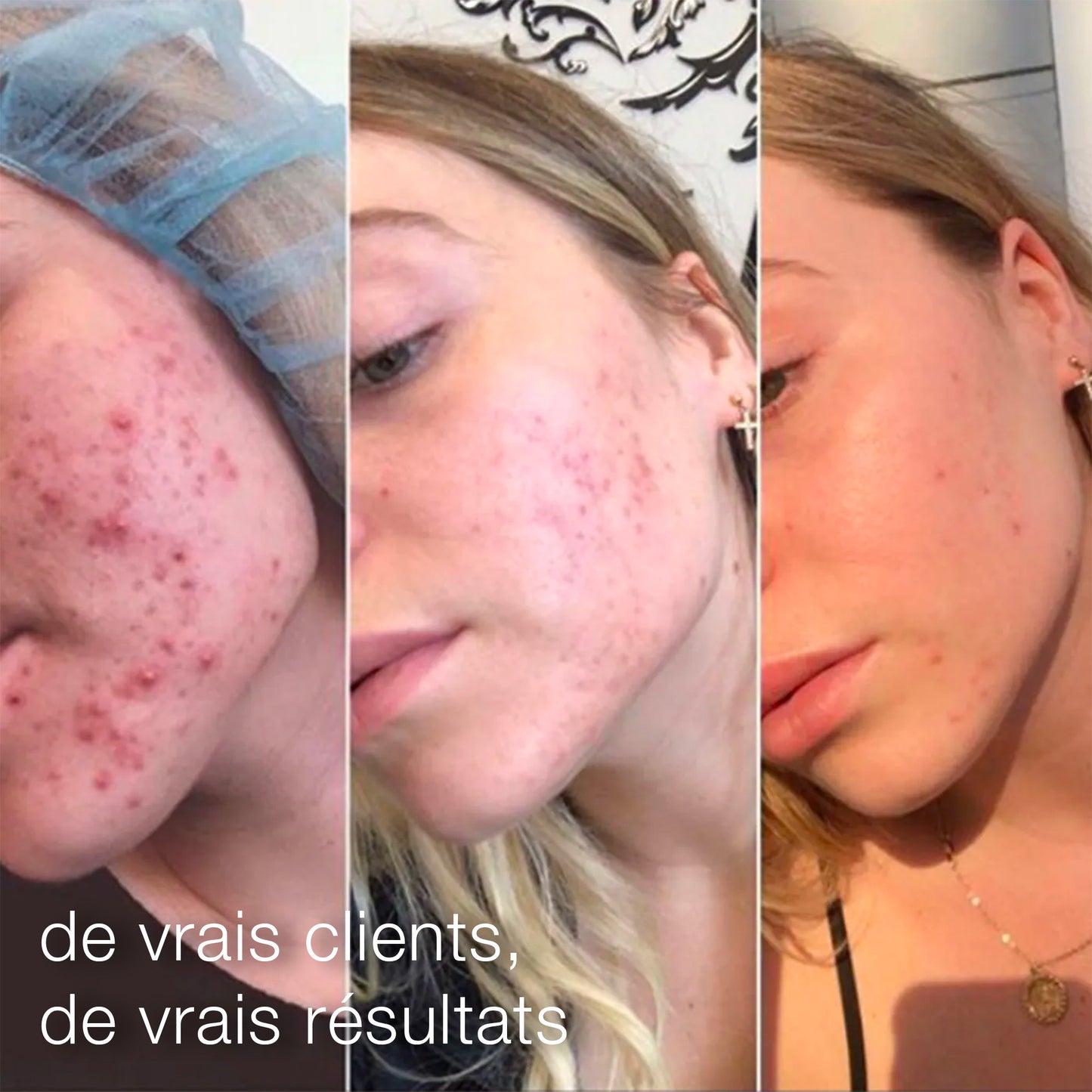 daily microfoliant | exfoliant quotidien universel best-seller