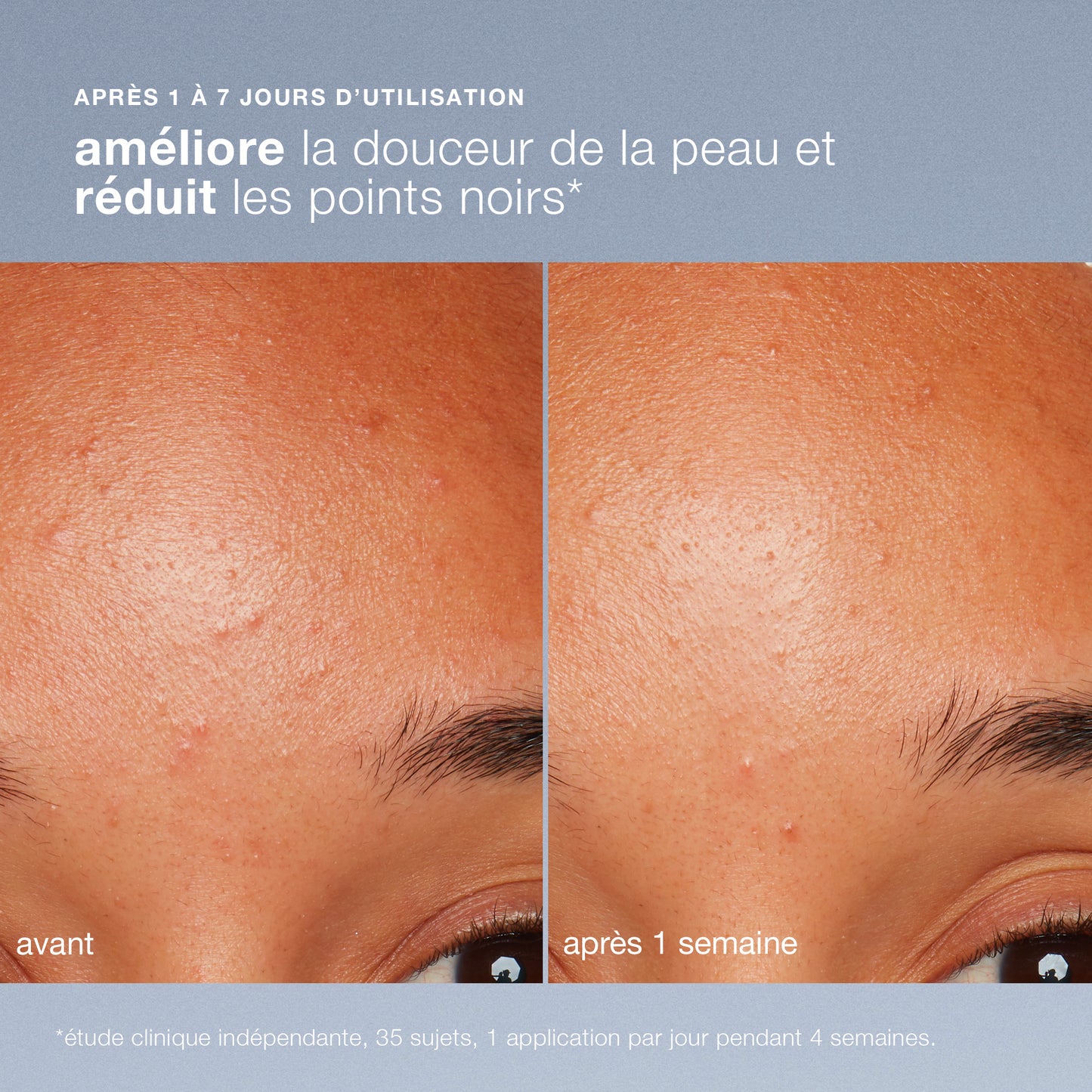 daily microfoliant | exfoliant quotidien universel best-seller