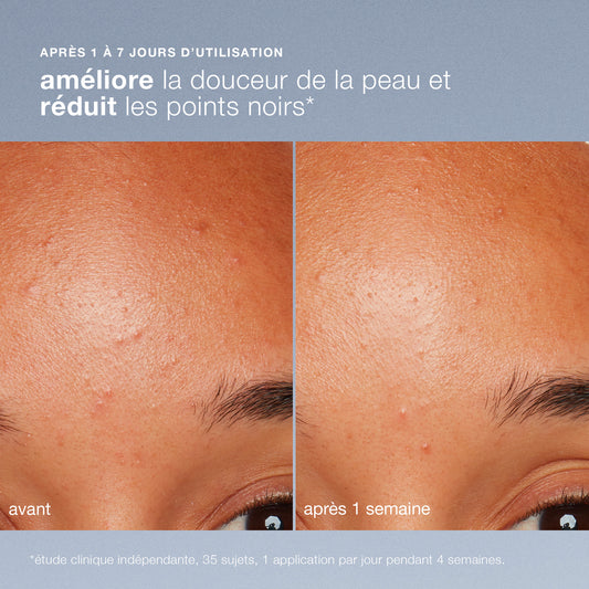daily microfoliant | exfoliant quotidien universel best-seller