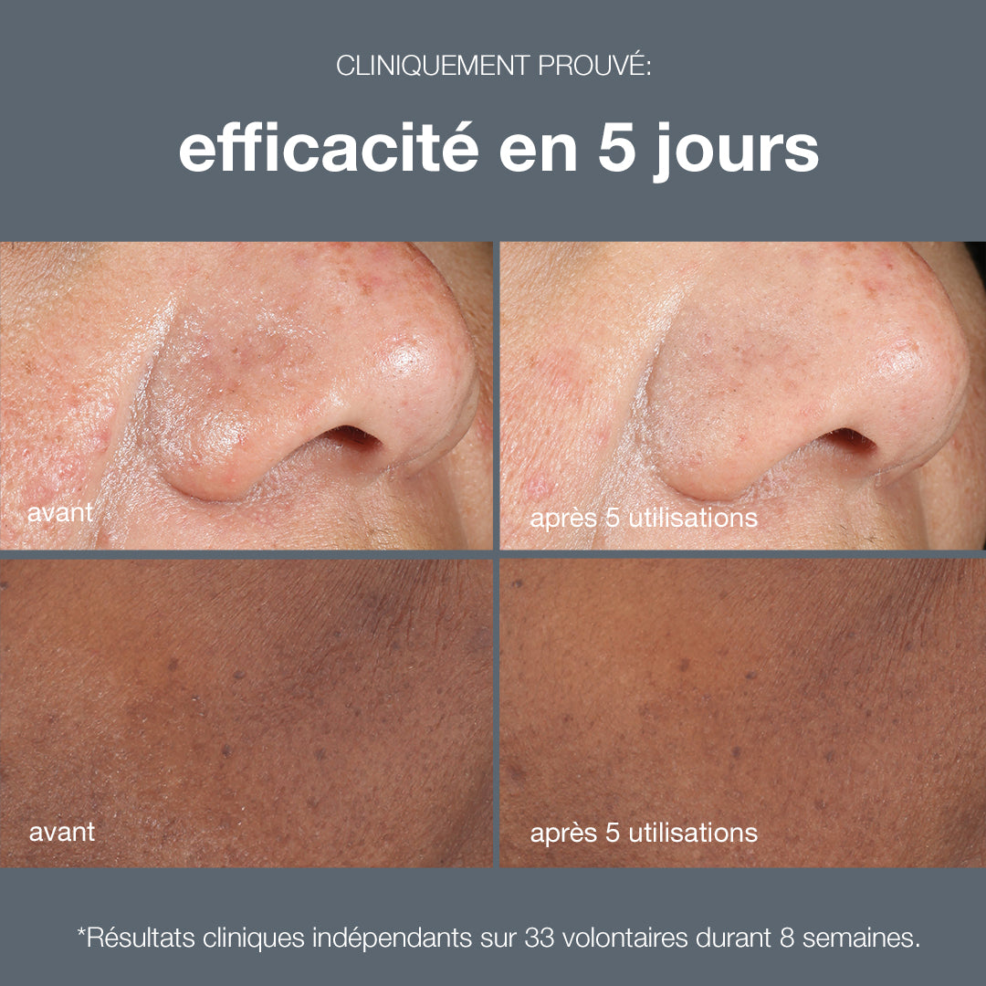 powerbright dark spot peel | masque peeling anti-taches et éclat