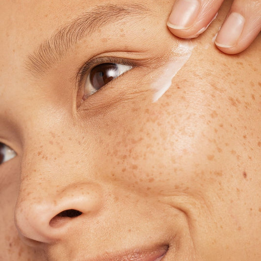 Cernes des yeux : les 4 types, leurs causes et quoi faire pour chacun