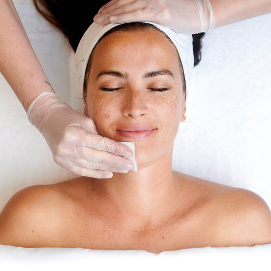 Peeling visage : résultats avant et après traitement