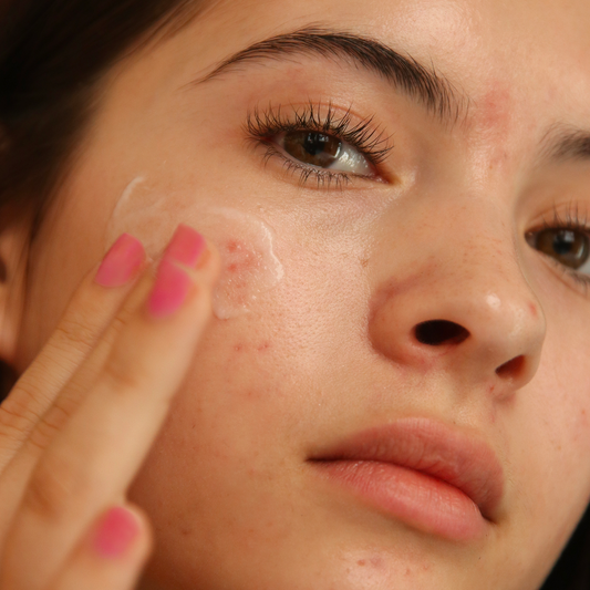 Peau terne, que faire ? Les causes et la routine qui ravive l'éclat
