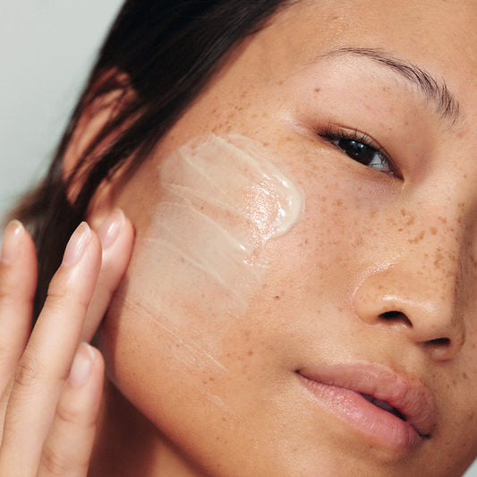 Masque de grossesse : pourquoi il apparaît et comment l'atténuer