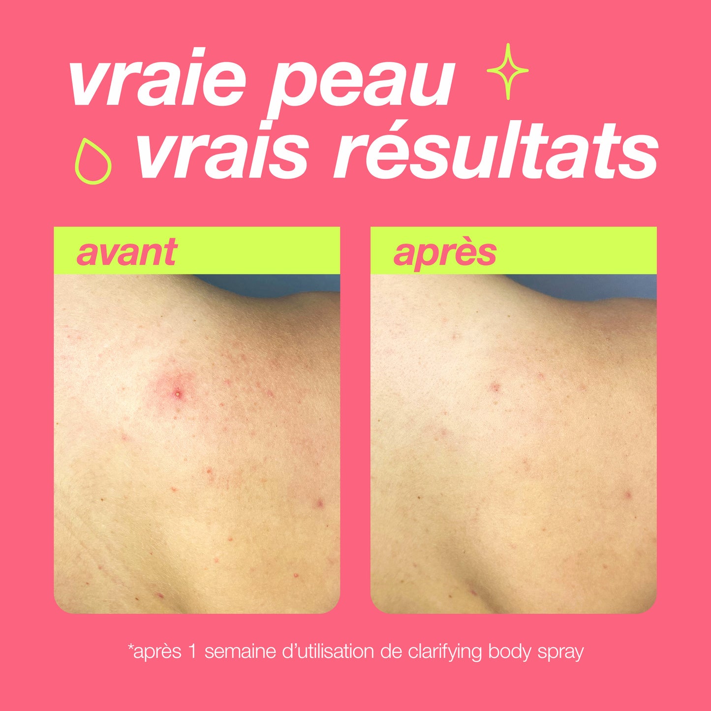 clarifying body spray | brume corporelle anti-imperfections purifiante