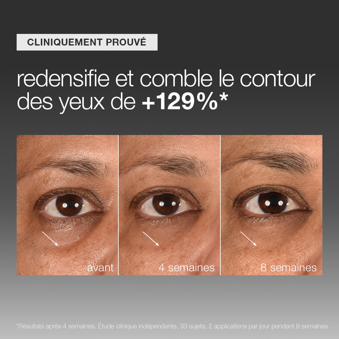 sérum yeux Smart Eye Density | sérum redensifiant et comblant cernes creux