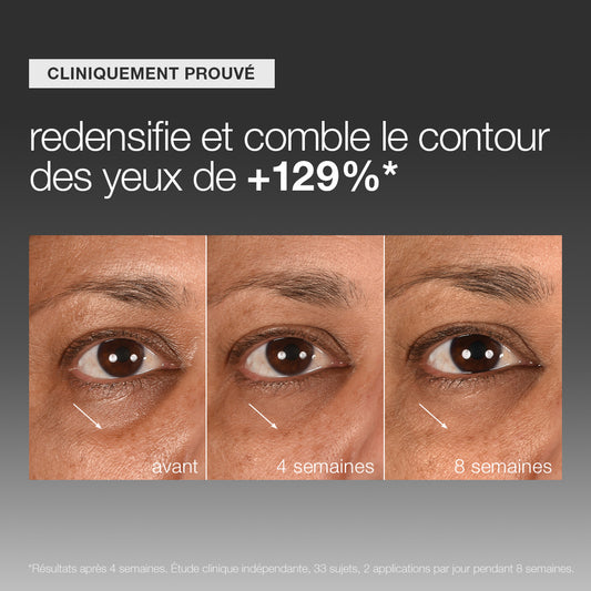 sérum yeux Smart Eye Density | sérum redensifiant et comblant cernes creux