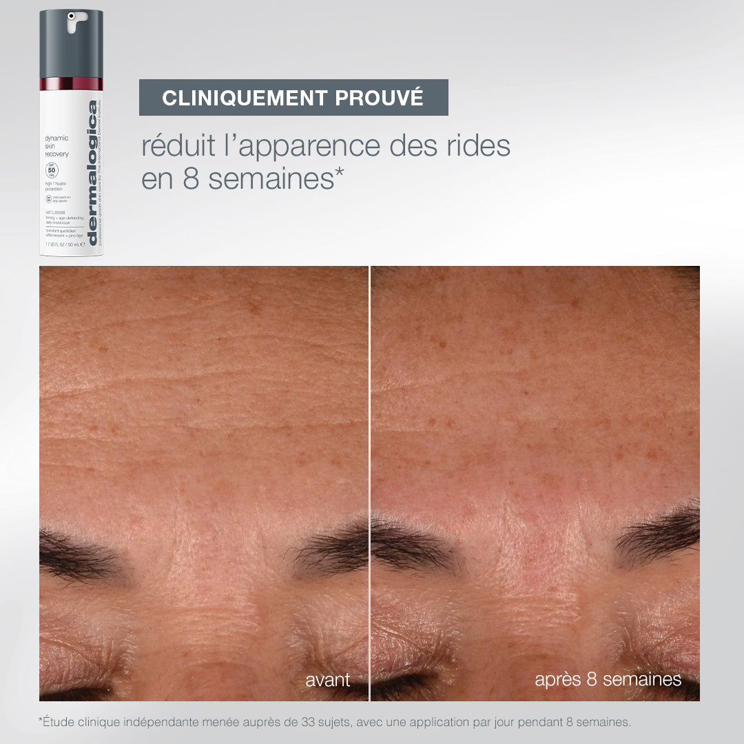 coffret Expert Protect + Renew | trio expert fermeté + protection