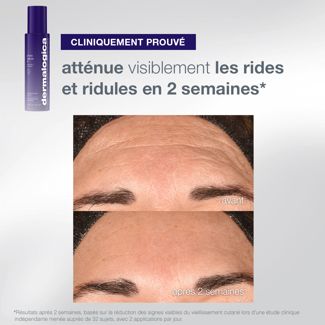coffret The Expert Lift | trio expert fermeté