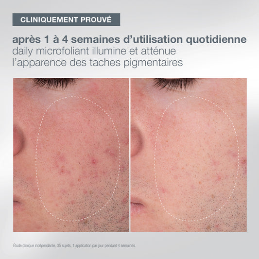 coffret first snow of the season | daily microfoliant – édition limitée