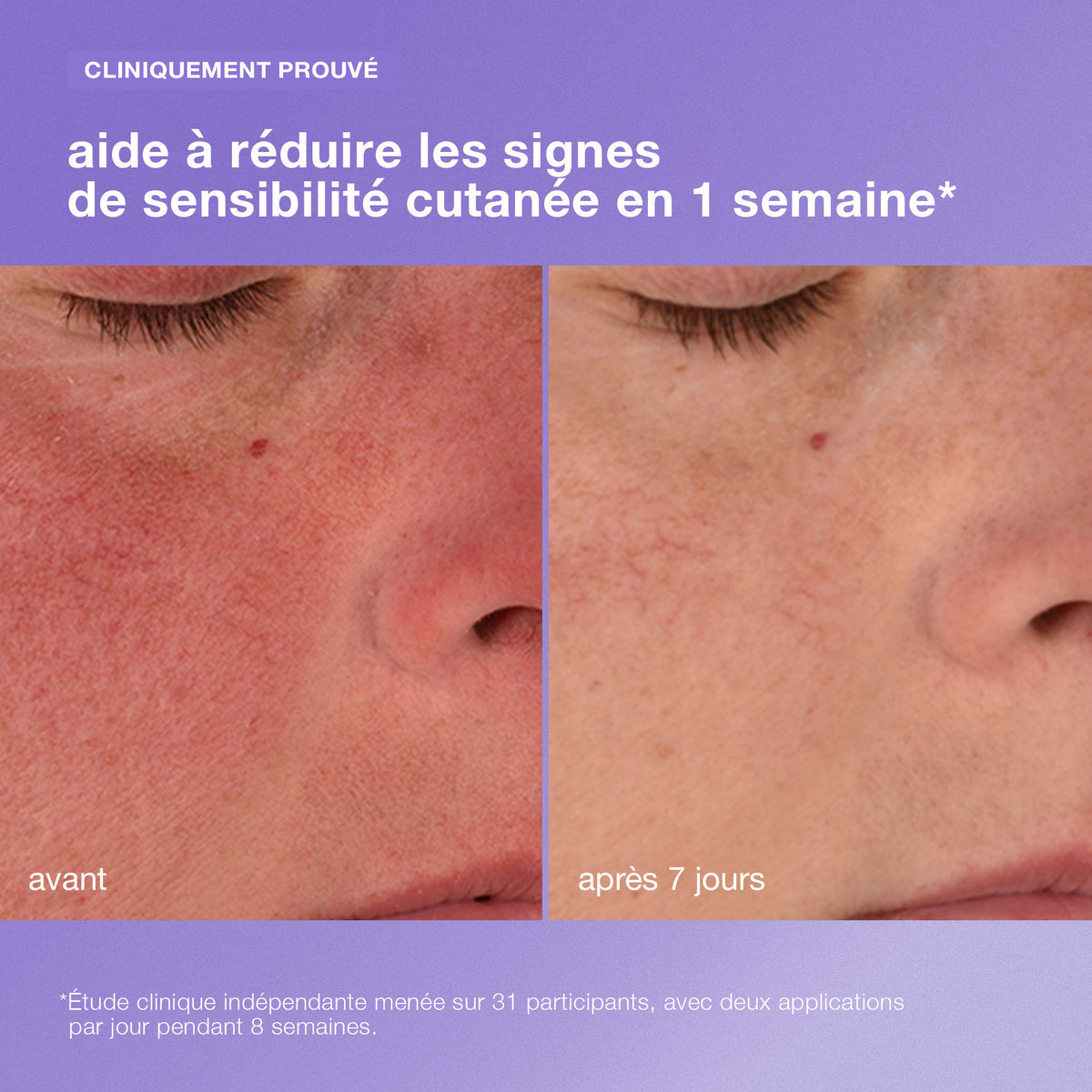 stabilizing repair cream |  baume réparateur aux céramides
