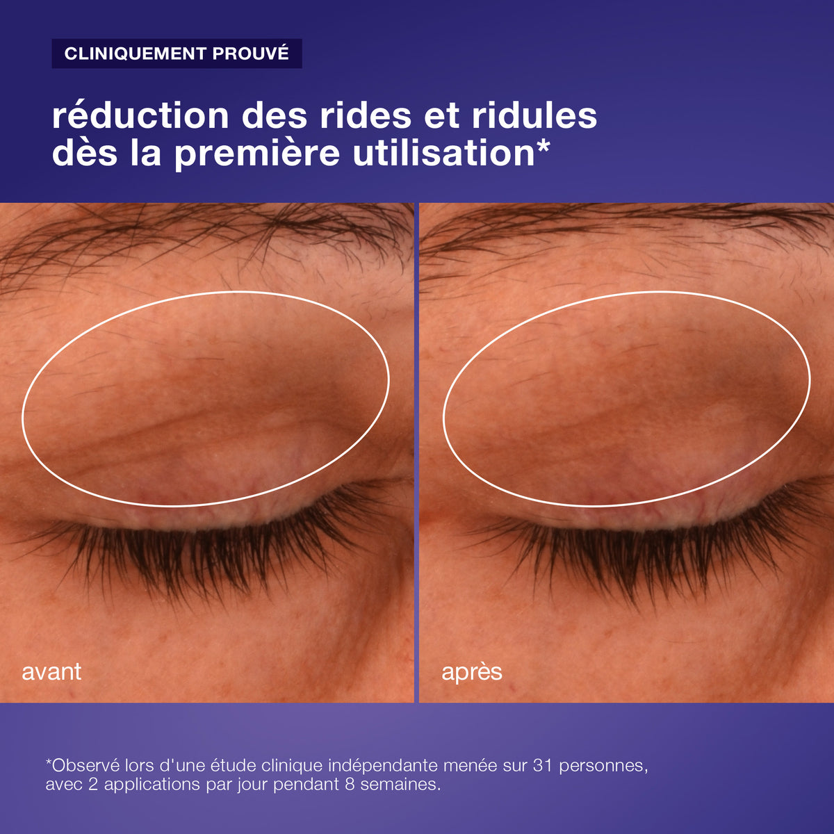 phyto nature lifting eye cream | crème contour des yeux liftante et raffermissante