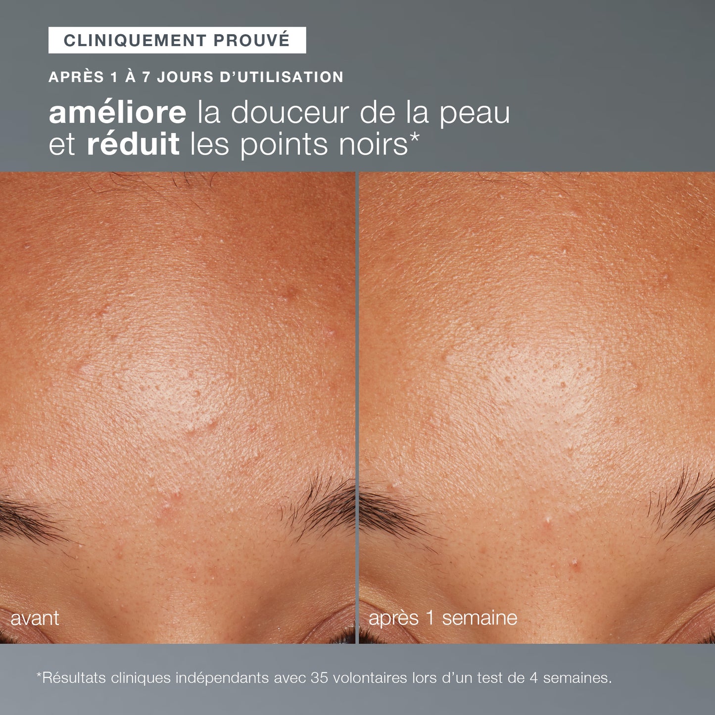 daily microfoliant | exfoliant quotidien universel best-seller