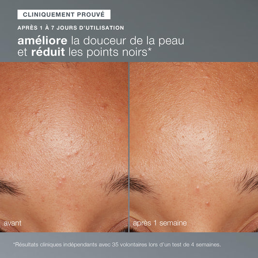 daily microfoliant | exfoliant quotidien universel best-seller