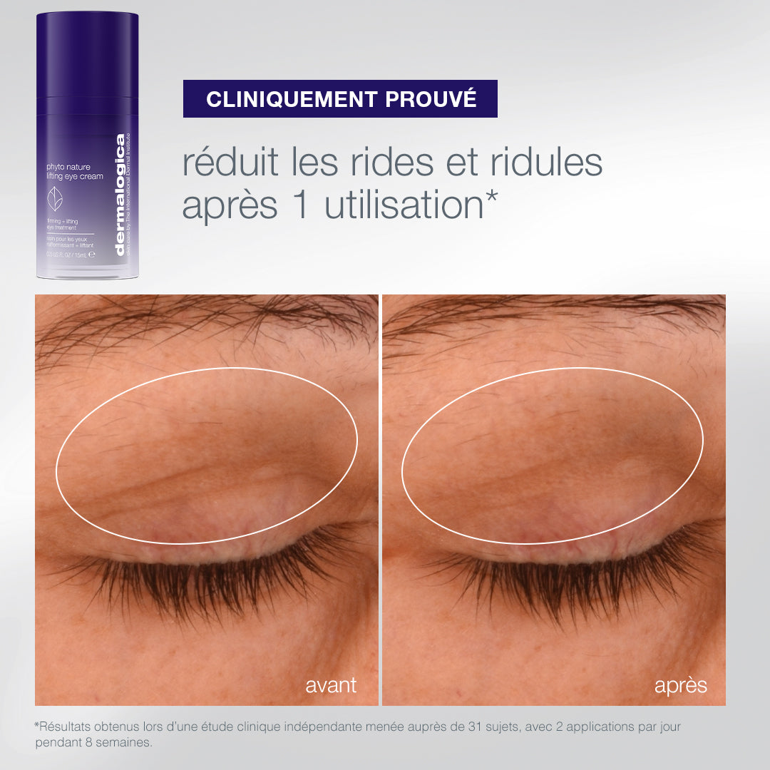 coffret The Expert Lift | trio expert fermeté