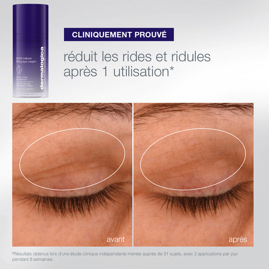 coffret The Expert Lift | trio expert fermeté