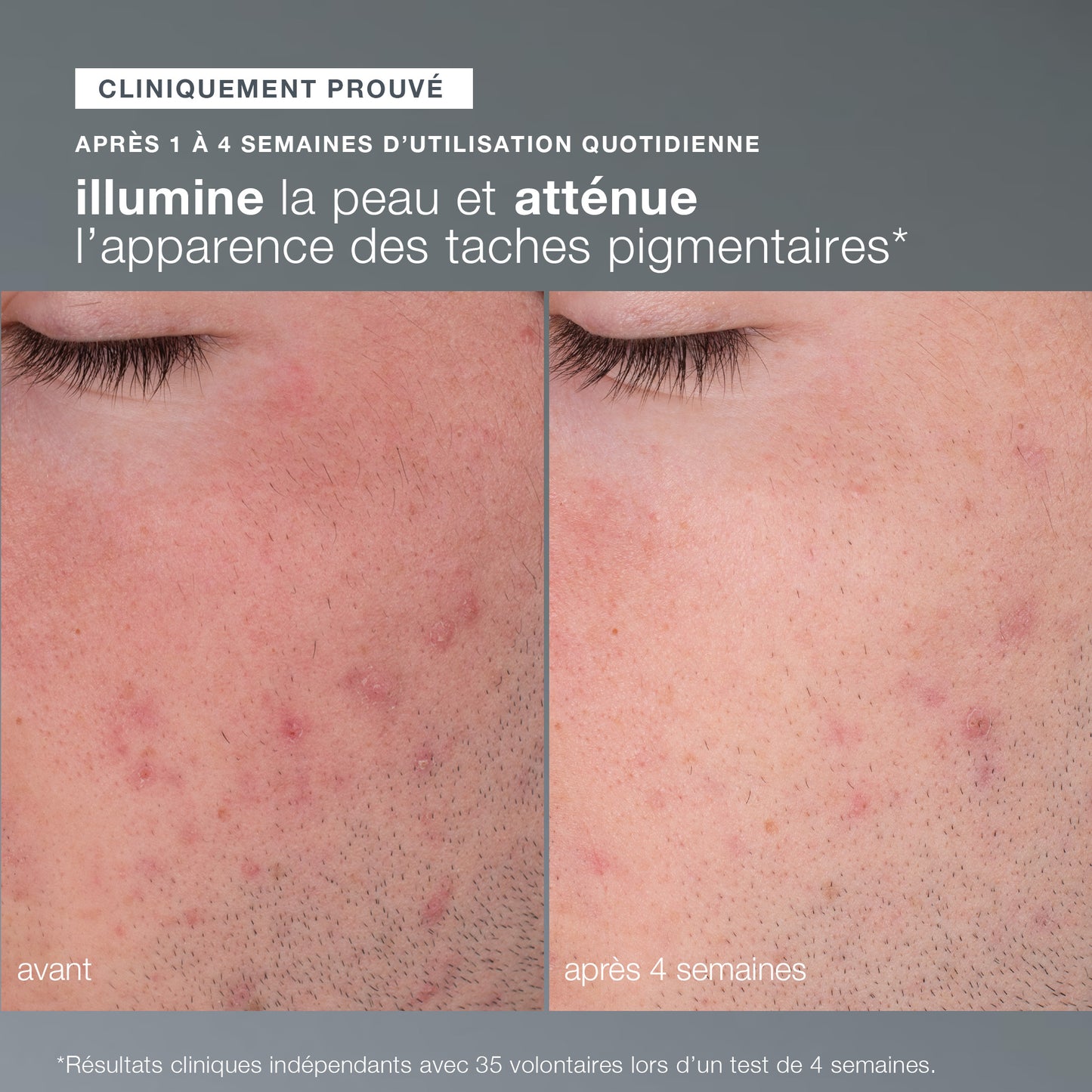 daily microfoliant | exfoliant quotidien universel best-seller