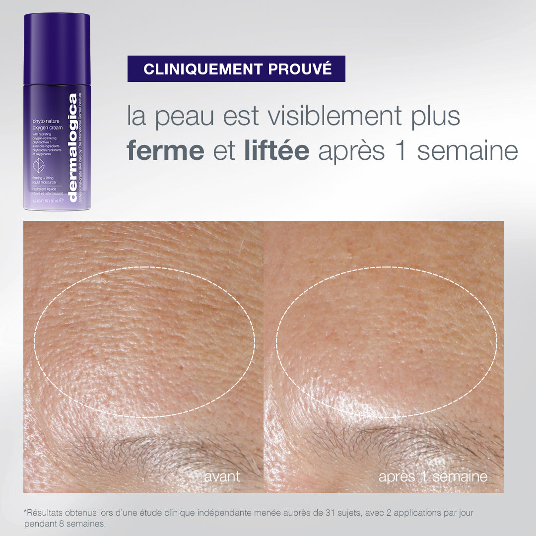 coffret The Expert Lift | trio expert fermeté