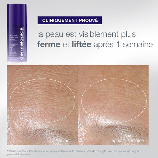 coffret The Expert Lift | trio expert fermeté