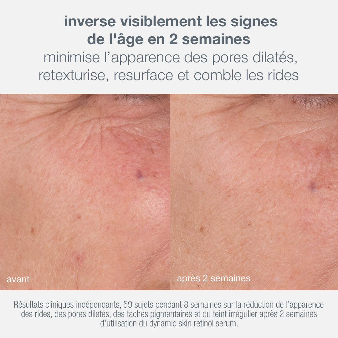 coffret skin aging solutions | coffret anti-âge et fermeté