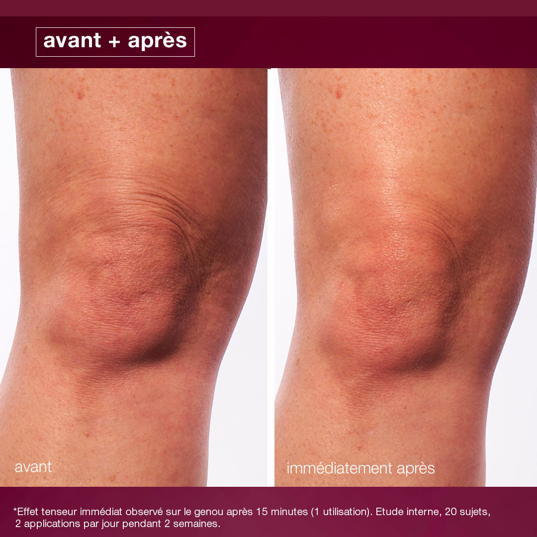 dynamic skin sculptor | sérum sculptant corps haute technologie – complexe pro-NAD+