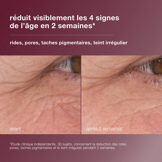 dynamic skin retinol serum 3,5% | sérum concentré au rétinol