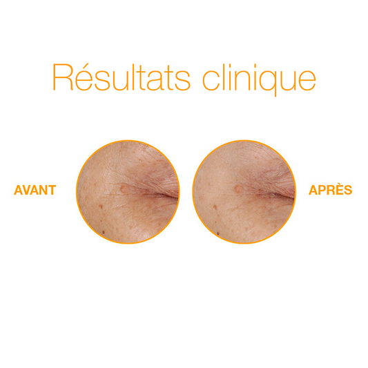 duo éclat vitamine C | biolumin-c serum et biolumin-c eye serum