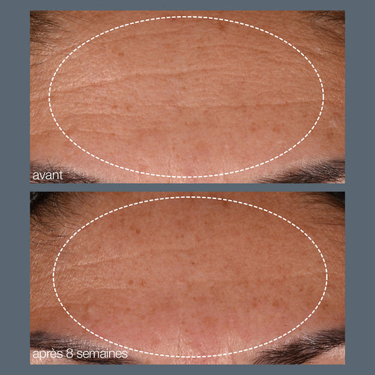 duo hydratant anti-âge | pro collagen banking serum + dynamic skin recovery spf50