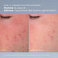 coffret skin transformation duo | duo exfoliation + protection