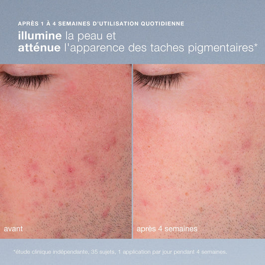 coffret skin transformation duo | duo exfoliation + protection